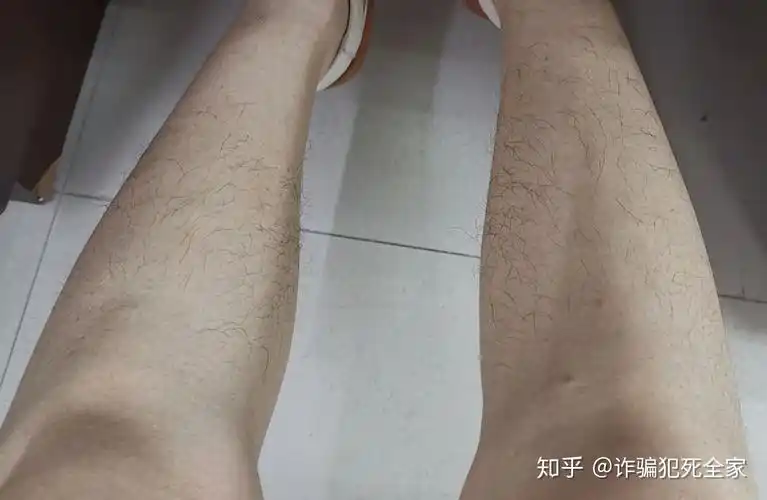 但是啊,腿毛啊,真是旺盛的要不得想看什么生活故事,想听什么真实案件