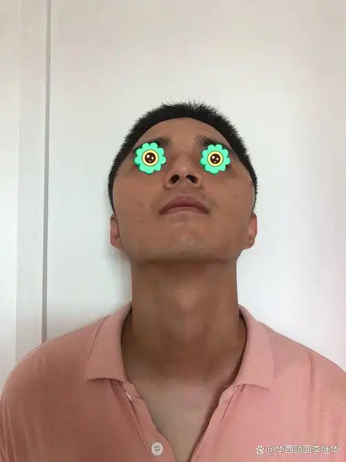 但现在我也成了帅哥