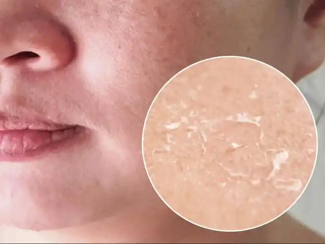 美容院diy自制天然补水面膜配方_皮肤_肌肤_小黄瓜