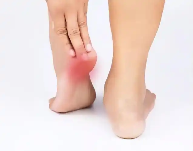 经常脚后跟痛不要觉得忍忍就好医生可能和3种病有关