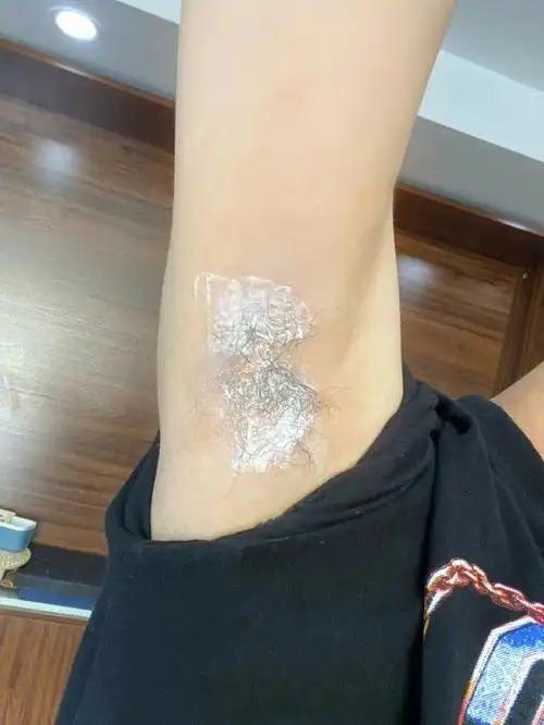 打工人脱毛日常,可太难为我的腋毛了!