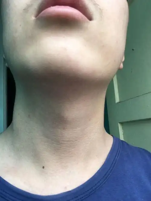 我摁的是图片凸起的那个喉结