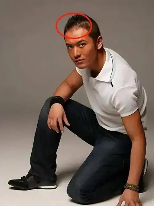 回顾:表面男神实则脱发严重!沙溢,彭于晏,白敬亭个个心酸好笑