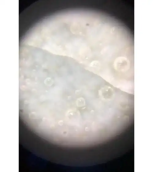 北宋汝窑釉下气泡画面