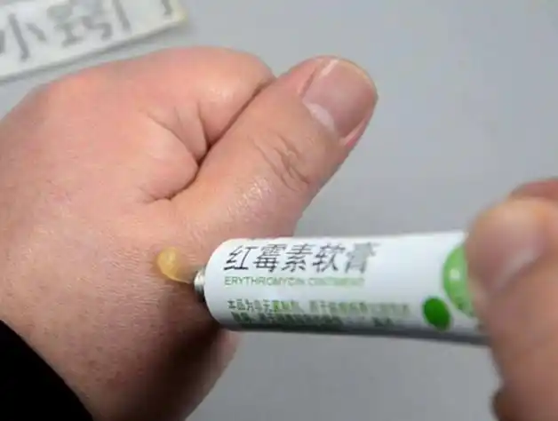 副作用3:耐药性再次声明,红霉素软膏在医学临床当中属于一种抗生素类