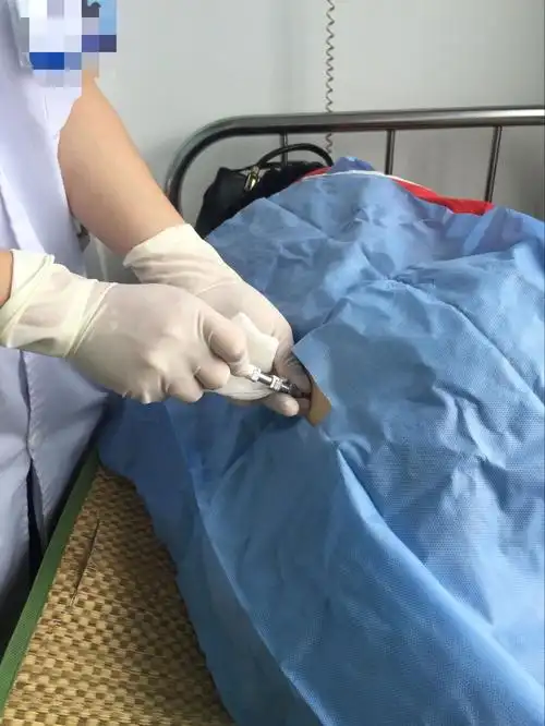 认识骨髓穿刺术 - 美篇