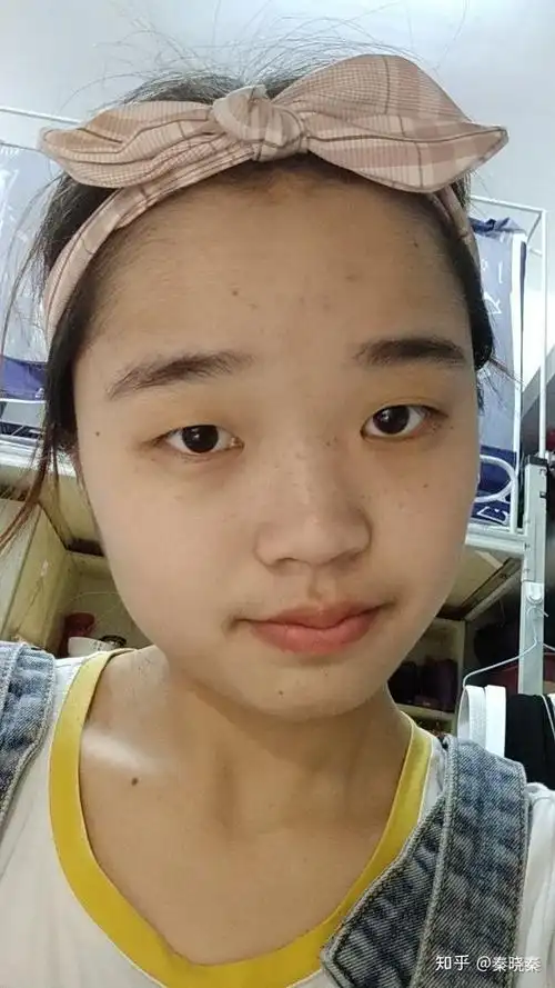 没有鼻梁鼻子塌的人是什么体验