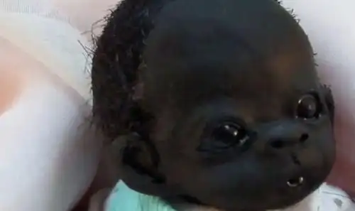 当年那个世界上最黑的婴儿,现如今过得怎么样了?_孩子