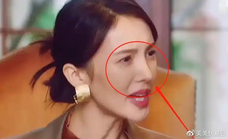 削骨颧骨内推高鼻尖这6位明星的脸大变动却说没整容