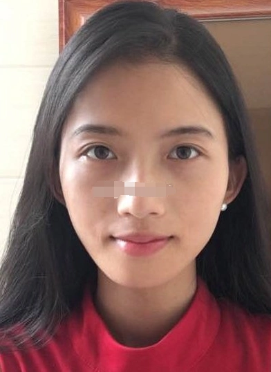 圆脸耳朵反骨法令纹不对称做事有主见能经商创业发展大