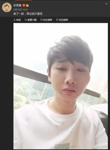 汪苏泷录节目摔倒颧骨肿起 晒自拍照不让笑