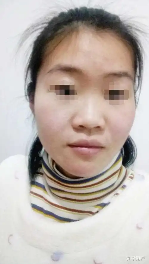 初中的时候,我的同桌说,你的鼻子好平啊,都看不到鼻梁.