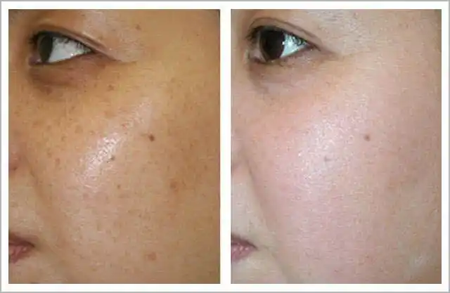 你还在为脸色暗黄而烦恼了解6大原因对症下药为颜值助力