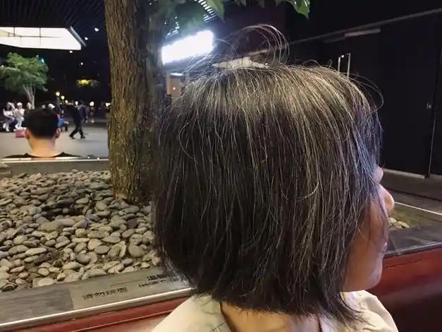 白发长在哪里,病就从哪里来?医生忠告:警惕这"3处"长白发!|肾脏|内分