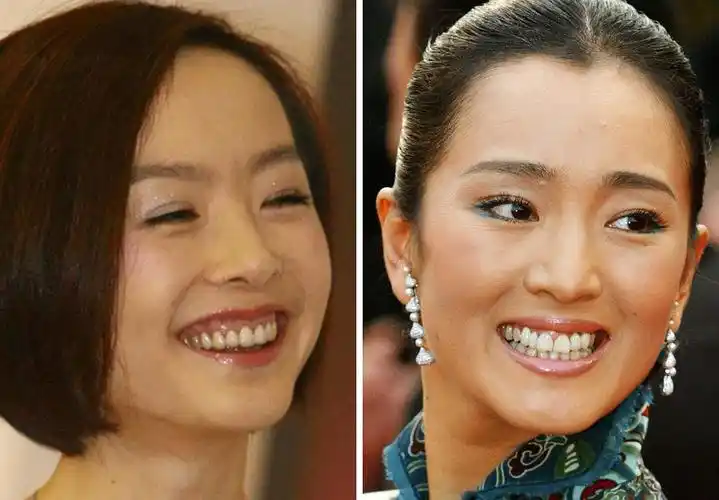 一个无聊而认真的研究:如何肉眼识别明星的假牙?