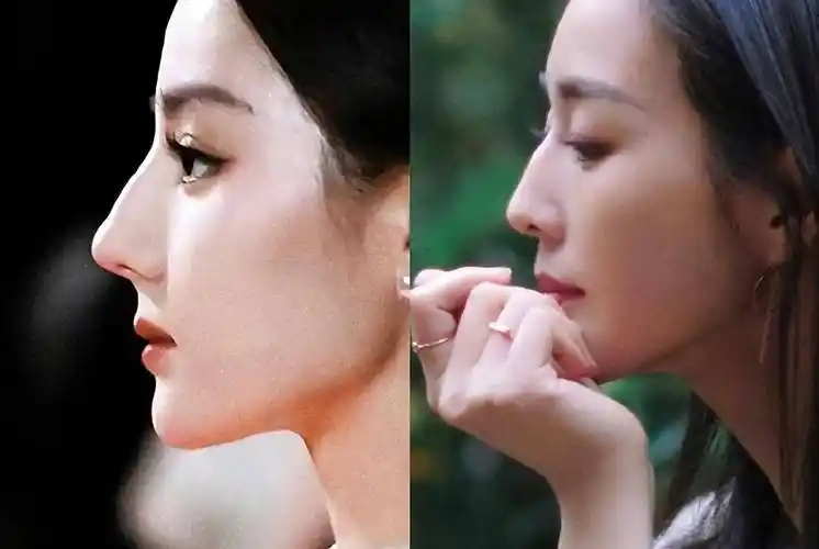 刘亦菲迪丽热巴侧颜仙图引爆骨相美,但盲目跟风做鼻子不可取!