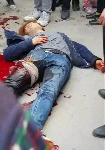 南充7名口罩男当街砍人2村民被砍成重伤