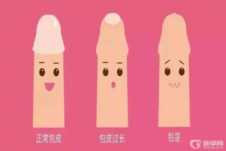 小孩子做包茎手术几岁合适,听听生殖专家怎么说