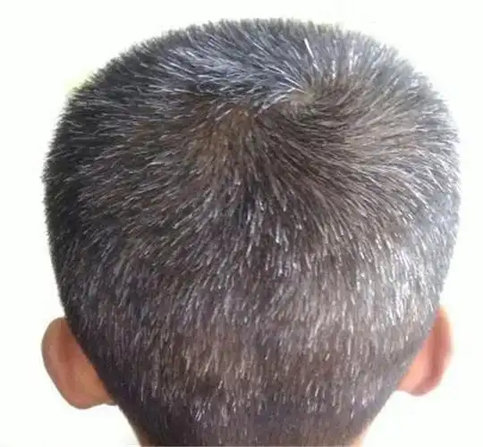 有些人20岁长满白发,有些人50岁头发依然乌黑亮丽,原因在这里