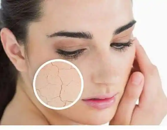 干性,中性,油性皮肤的判断和保养