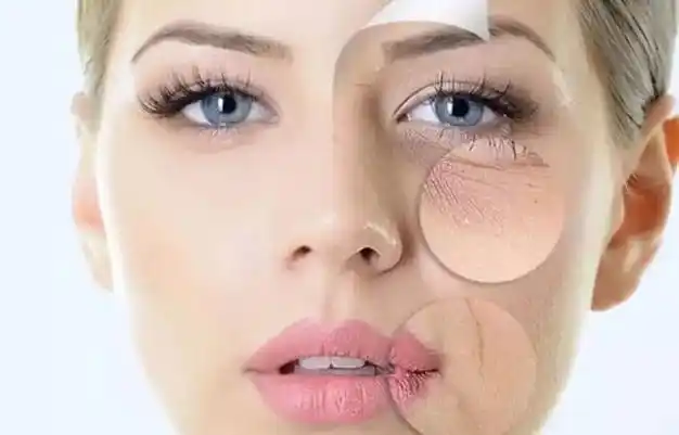 中年肌肤问题你都有吗