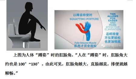 女人用蹲坐马桶拉不出粑粑,男人们怎么破