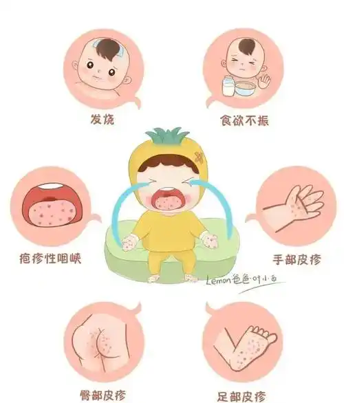 【卫生保健】预防手足口 健康我先行——龙江实验幼儿园手足口病预防
