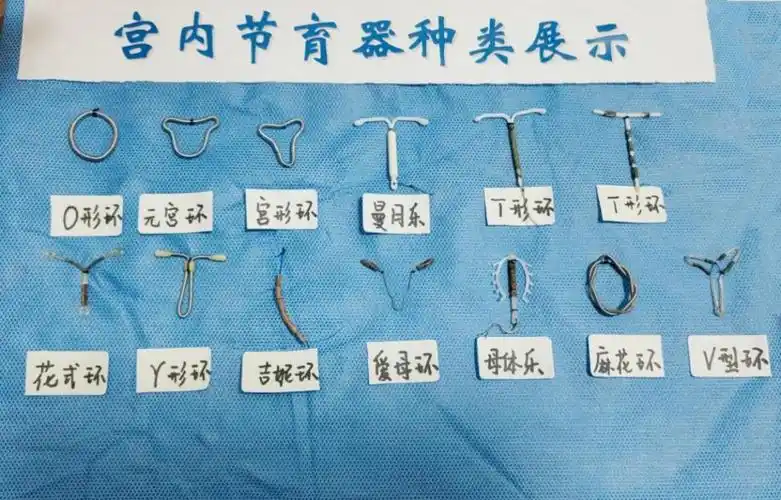 苏大附一院|计划生育|妇产科|节育器|宫颈|-健康界