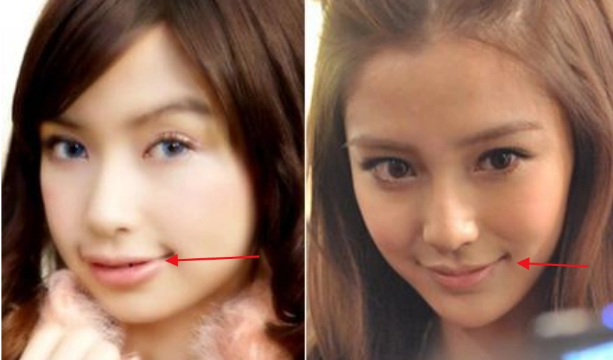 娱乐圈扒皮系列——第二期,杨颖(angelababy)整容史分析