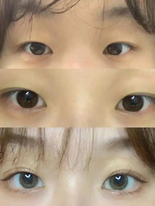 内双别再到处找双眼皮贴了快进来555