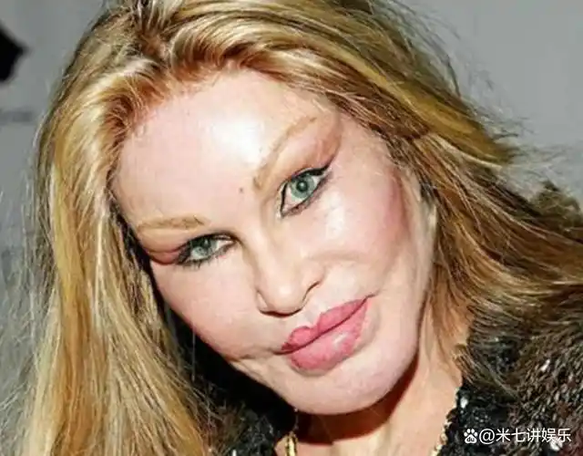 山西:一女子为变美,整6d少女脸失败,网友:整容需谨慎