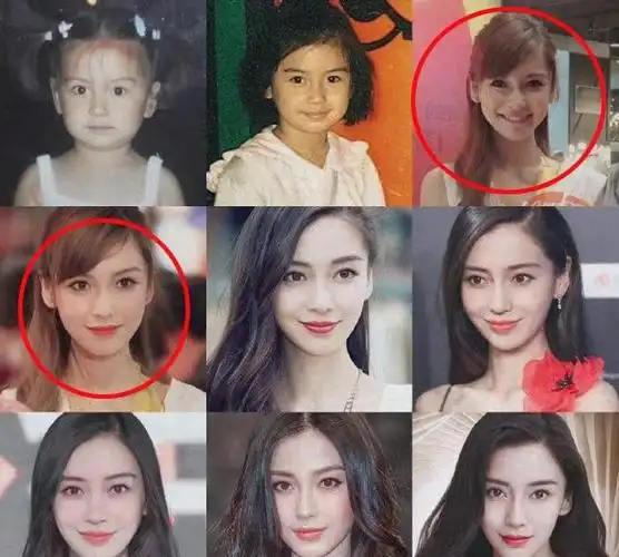 angelababy飞风:多年等她脸掉下来的人这次都惊呆了|杨颖|整容|黄晓明