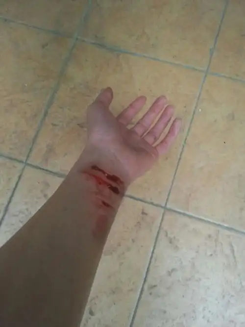 伤口在大一点 地上血在多一点 谢谢了啊