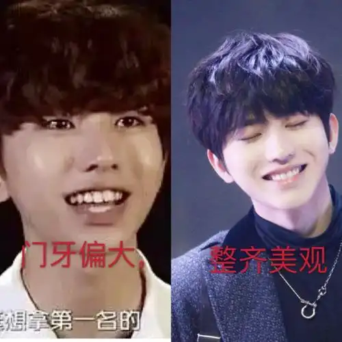 蔡徐坤|整容还是整牙?