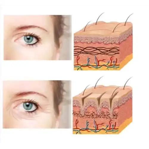 你想拥有20岁的肌肤,就要从20岁保养 想要30岁的皮肤在30岁就要抓紧