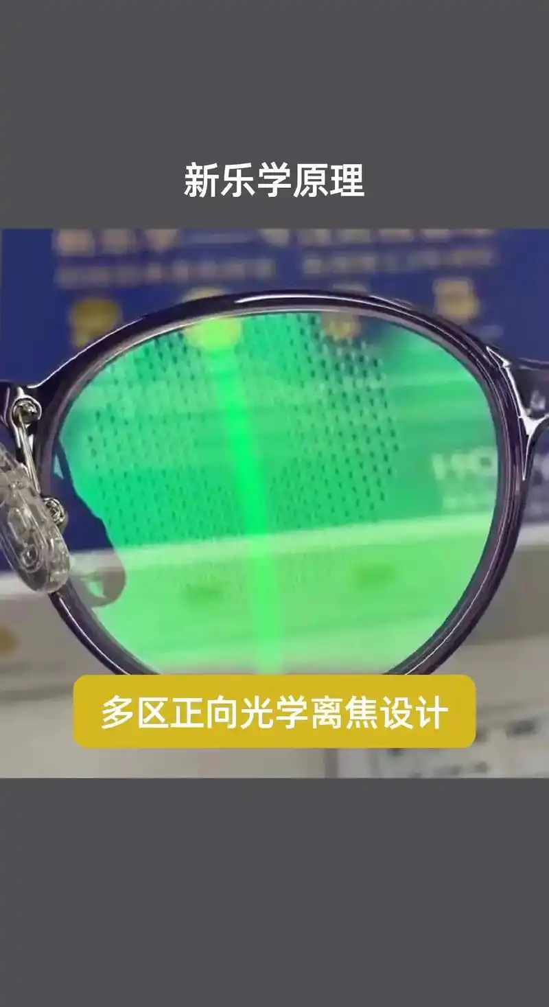 这是专门为儿童设计的近视防控镜片,现在孩子近视的情况越来越多