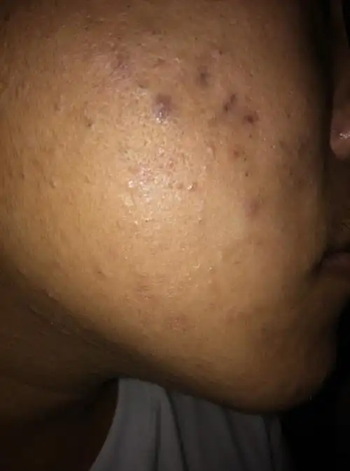 皮肤一直都很差怎么办