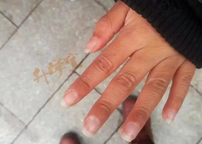 13名小学生排队让校长剪指甲背后的故事比太阳还温暖