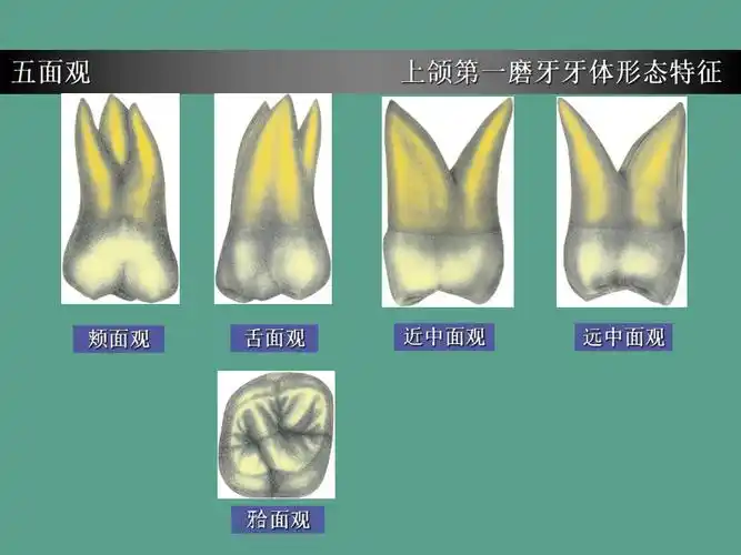 上颌第一磨牙牙体形态简述ppt课件