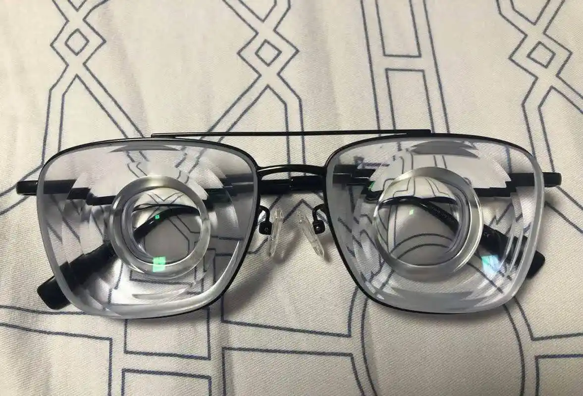 5000度以上的近视眼镜厚度[坏笑]