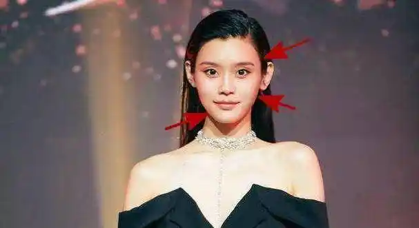 奚梦瑶自曝脸上是花了钱的!