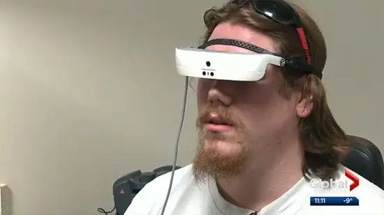 esight眼镜令凯文重见光明.(photo: global news)