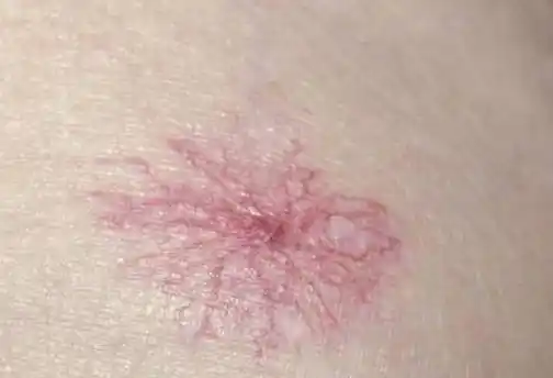 检查_知识_部位