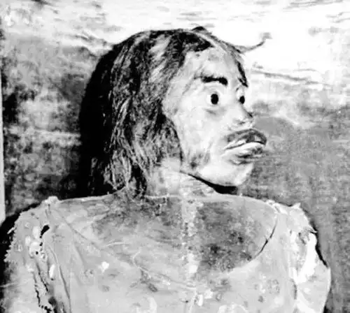 世界上最丑的女人也是世界上最惨的女人死后也被展览