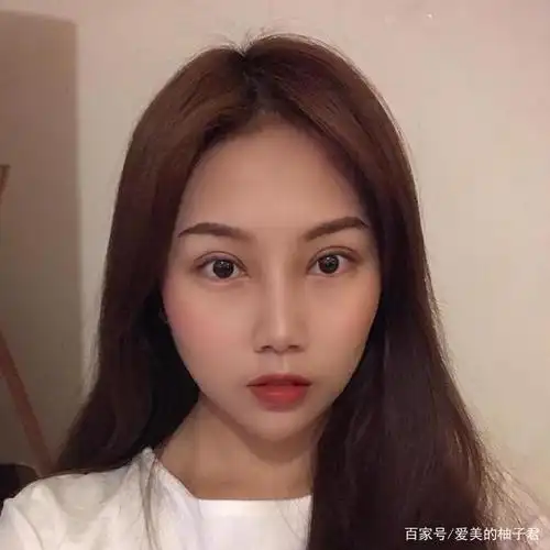 我的全切双眼皮分享:小内双 肿泡眼的完美蜕变!