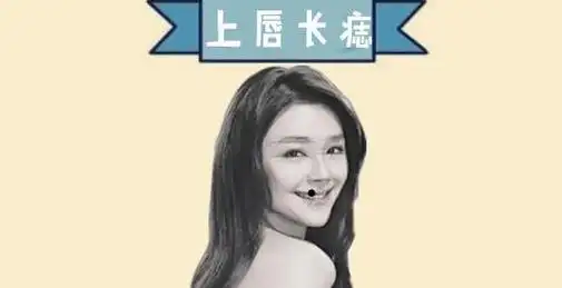 女人五颗"金痣"藏暗财,手握金山,高不可攀,个个财大气粗