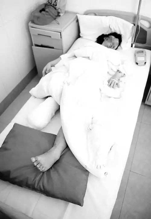 人物:16岁少女小曾事件:上班途中遭遇车祸,右腿截肢台海网7月18日讯