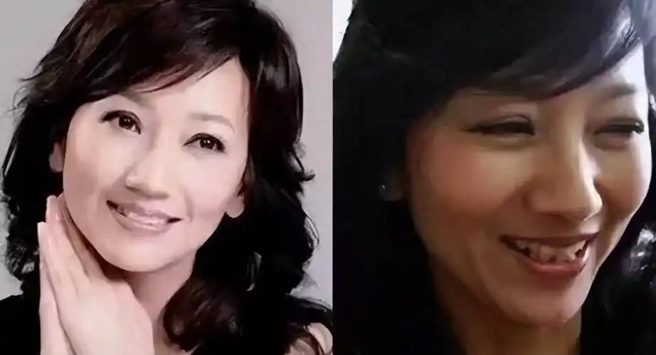 挂满了皱纹,没有妆容的加持下,老态尽现,可惜赵雅芝似乎不太想承认