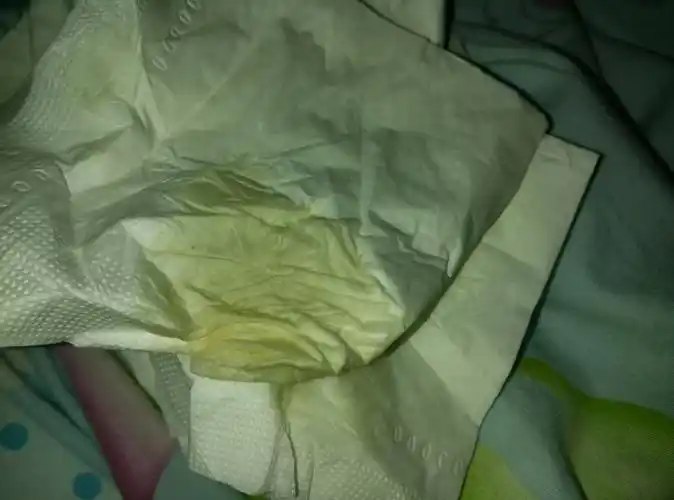 亲们,帮我看看,怎么分泌物是黄色的.