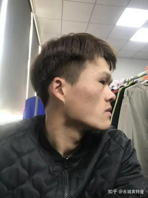 为啥侧脸看着怪怪的有了解的嘛